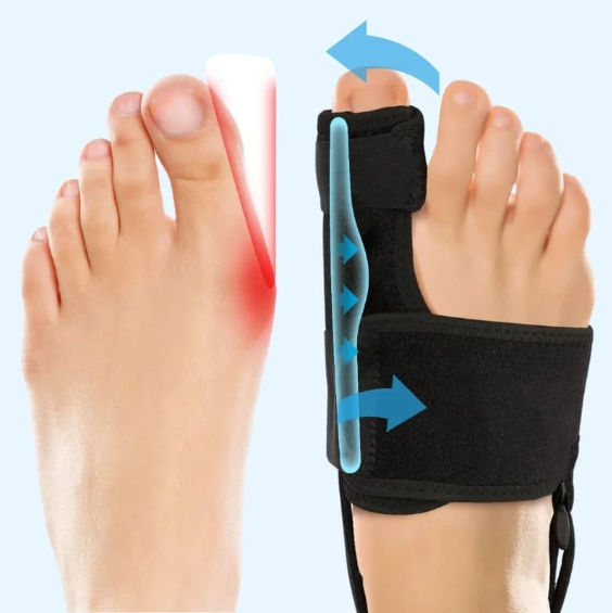 Luxird | Comfort Bunion Corrector