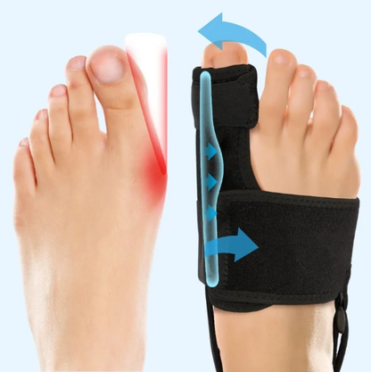 Luxird | Comfort Bunion Corrector